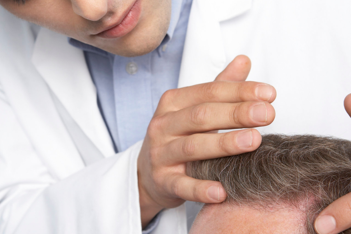 Quelles sont les meilleures coupes de cheveux homme pour cacher une
